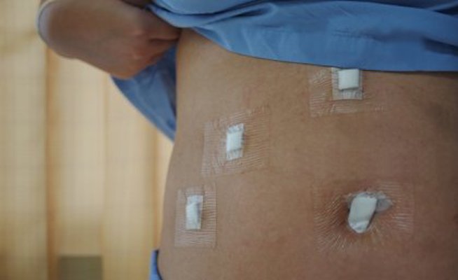 Put A Stop To Unnecessary Hysterectomies Say Doctors HealthySoch